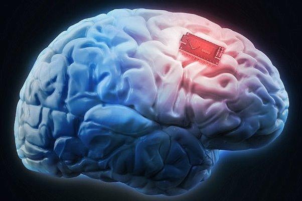 تشخیص بیماری های مغز و اعصاب به کمک فناوری های نوین پزشکی